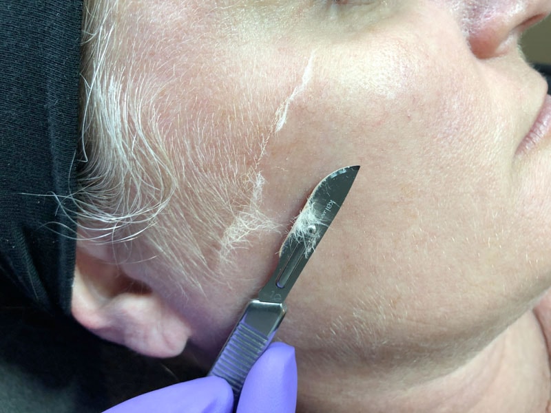 Dermalogica Facials & Dermaplaning